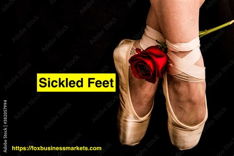 what is a sickled foot in dance? the role of music in shaping the expression of this technique